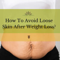 how to avoid loose skin after weight loss