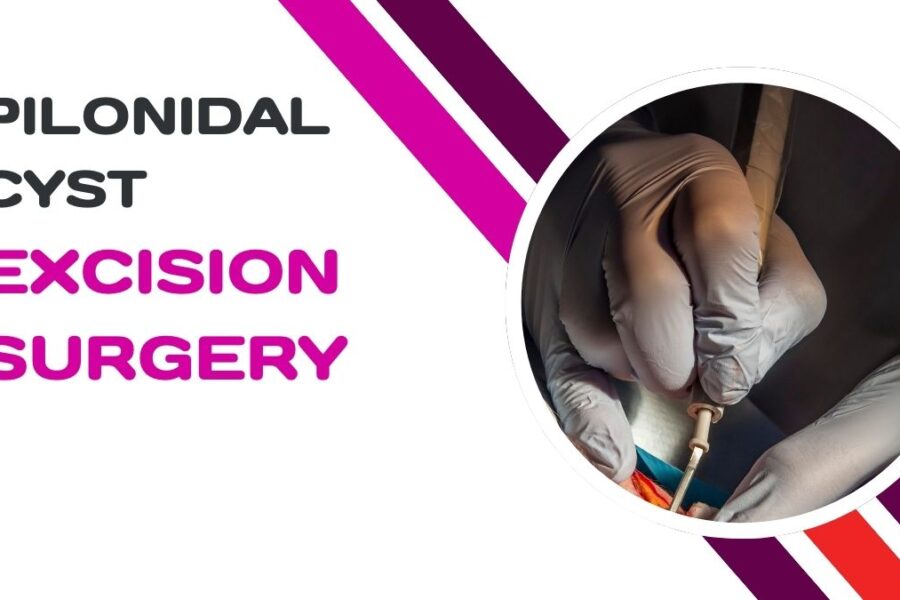 pilonidal cyst excision surgery