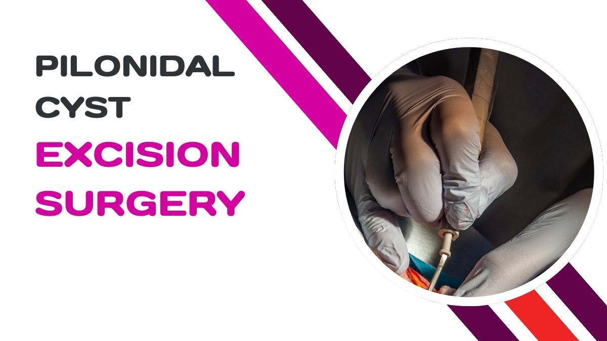 pilonidal cyst excision surgery