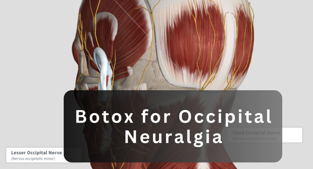 botox for occipital neuralgia