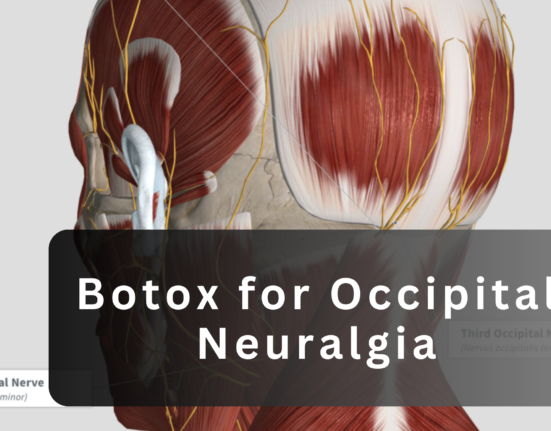 botox for occipital neuralgia