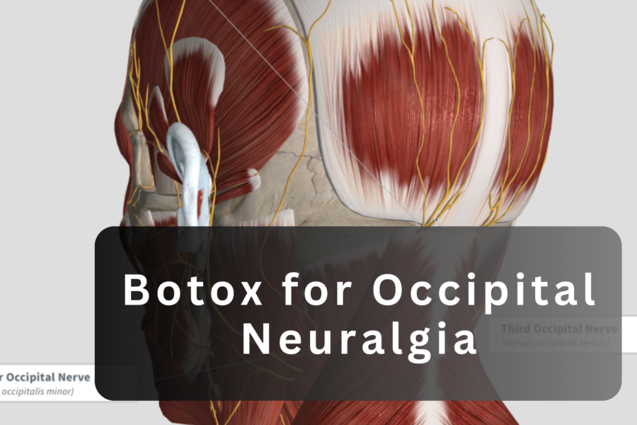 botox for occipital neuralgia